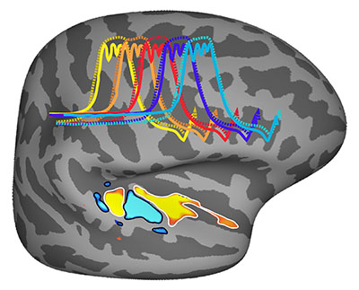 Music in the brain, MIT News