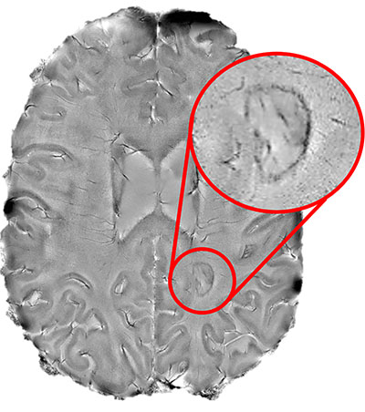 cross section of brain from above