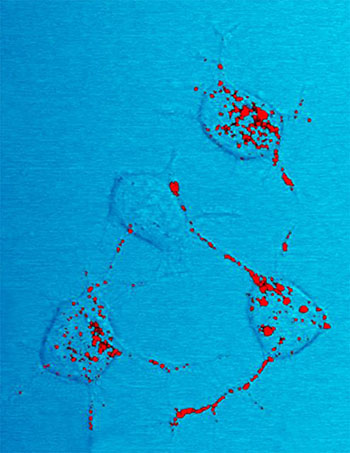 prion proteins in red