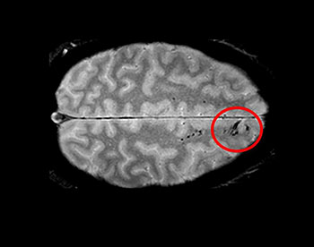 image of cross section of brain