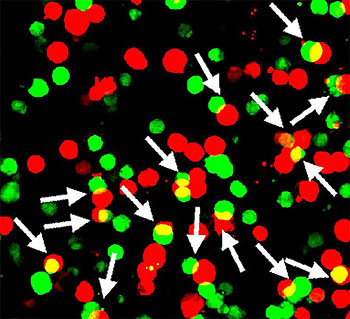 a protein encoded by a gene called Shisa7 (green) may boost the nerve-calming effects of diazepam (a.k.a. Valium) and other benzodiazepines by sticking to GABA type A neurotransmitter receptors (red)