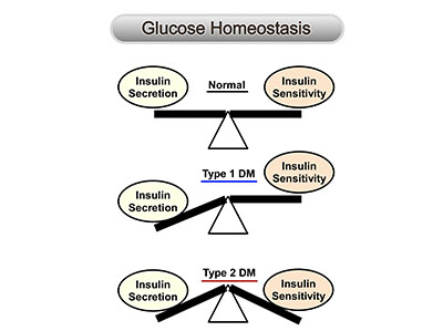 diagram entitied &quot;Glucose Homeostasis&quot; depicting normal, type 1 diabetes, and type 2 diabetes