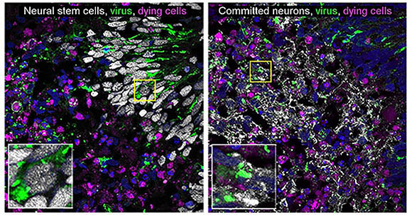 Multicolored microscopic images of neurons