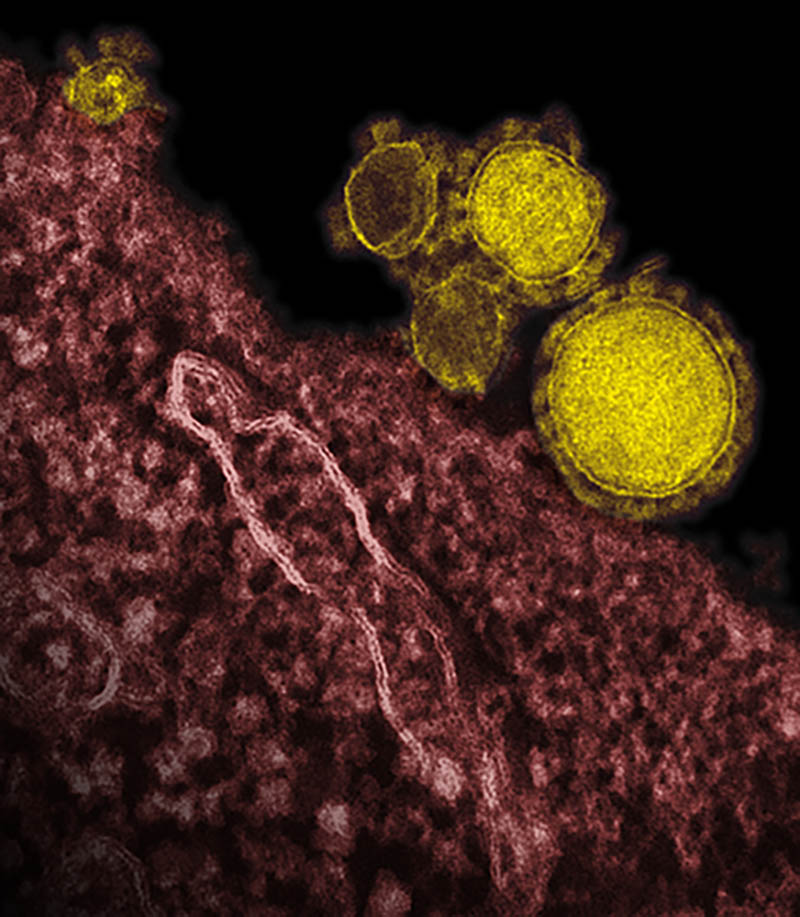 coronavirus--yellow balls on purple background