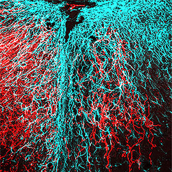 red and cyan colored nerve fibers with black area indicating where injury is; looks like a stringy mess.