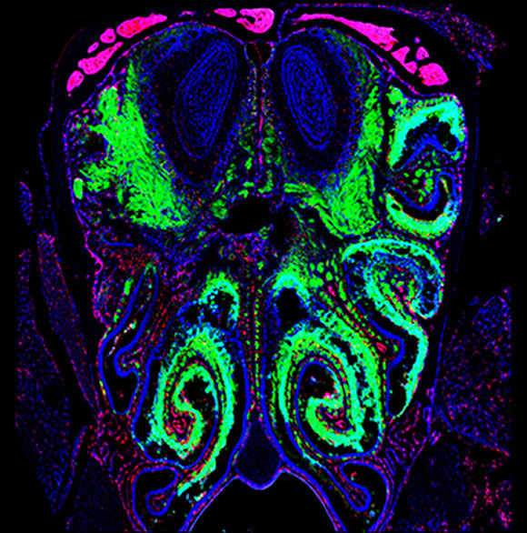 colorized image of brain showing nasal passages and olfactory bulb