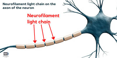 Illustration of axon and neurofilament light chain