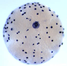 flatworm embryo--look like a white ball with blue specks on it and a large blue circle in the center