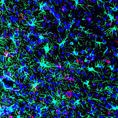 blue and greenish cells of Zika-infected mouse brain