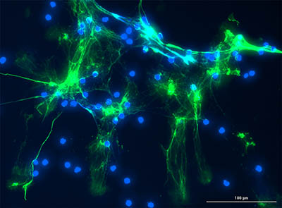 neutrophils