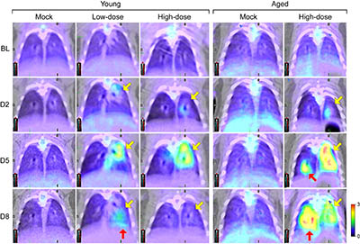  series of PET images of mouse lungs