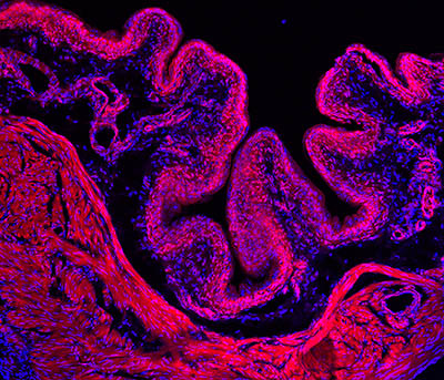 red and blue tissue of bladder