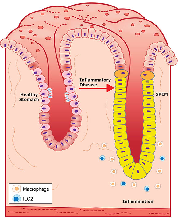  illustration of cross section of lung