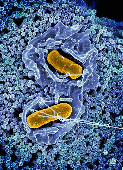 gold-colored salmonella in blue colored tissue and cells