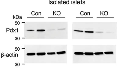 western blot images--gray background with black horizontal bars