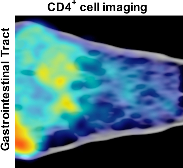 CD4 cells in colon, SIV