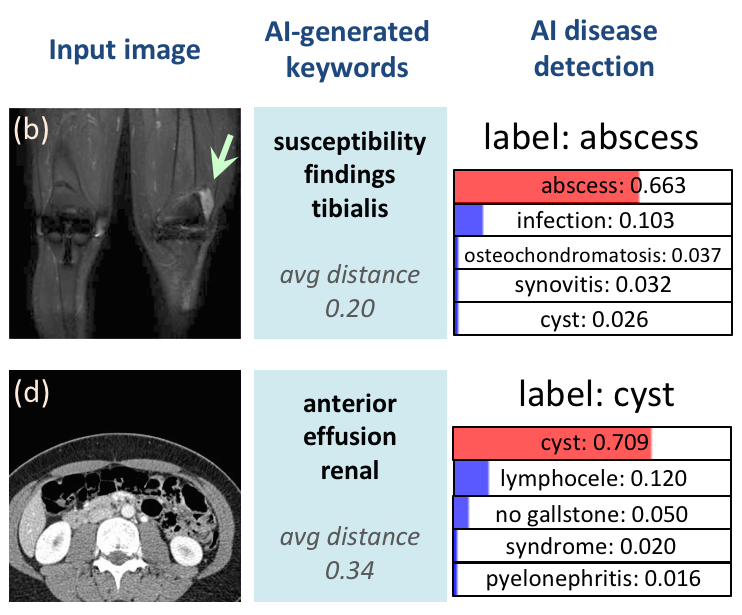 Example artificial intelligence disease detection from radiology images, NIH IRP, cropped