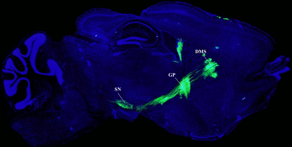 Optogenetics