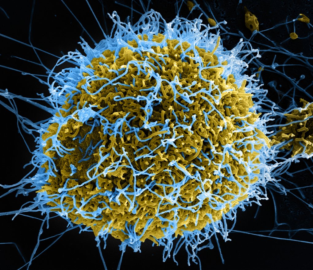 ebola-virus-particles