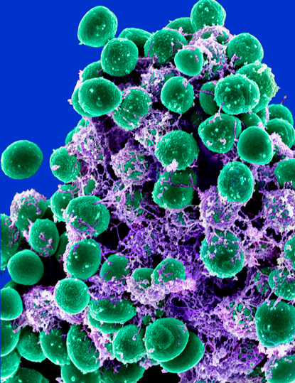 Green balls representing biofilm embedded in purple matrix