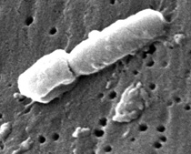 Klebsiella bacteria--looks like a short whitish worm