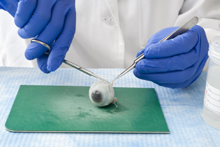 eyeball on mat; two hands in blue gloves holding implements that are touching the eyeball