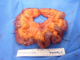  section of intestine