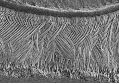 lattice pattern on tooth enamel looks like fibers in a macrame bracelet