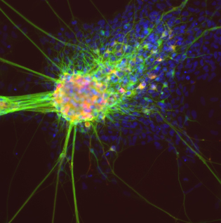 view of neurons--looks like something from outer space