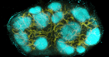 microscopic view of lymph nodes