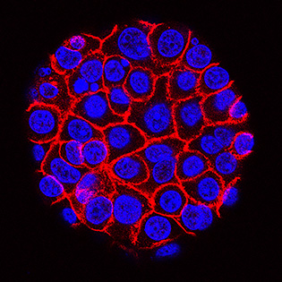 Cells surrounded by membranes