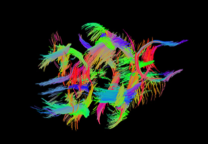 Colorful depiction of white matter in brain.