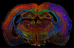 cross-section of brain in many colors