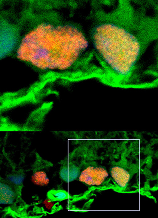 magnified ganglion cells