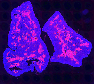 image of thymus magnified