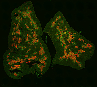 magnified image of thymus