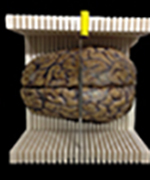 top view of a brain in a cutting box
