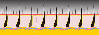 illustration of hair follicles