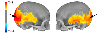 Illustration of two skulls, side views, facing each other