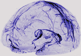 Image of brain in purple; purple represents the lymphatic vessels.