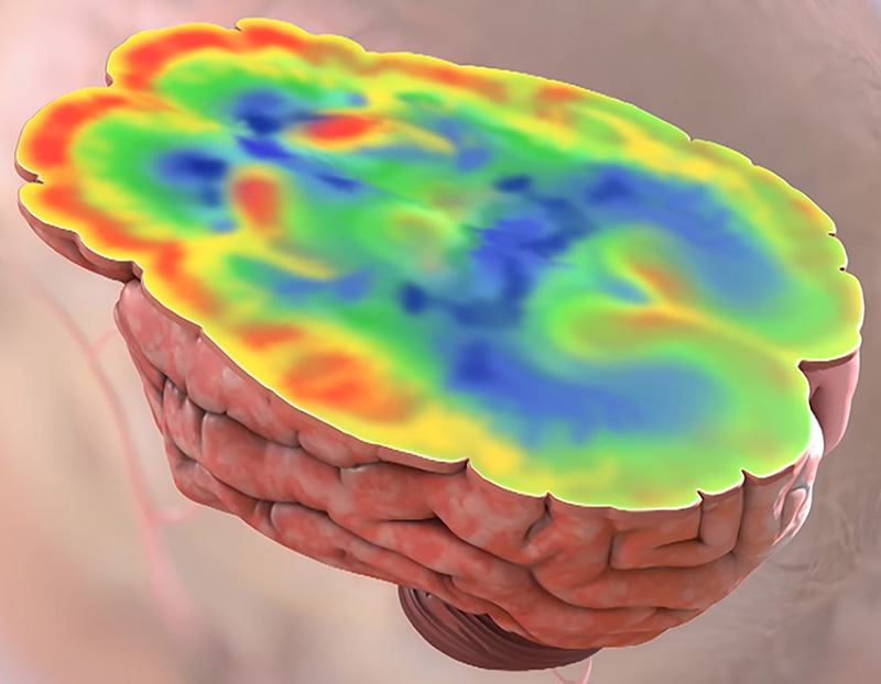 illustration of cross section of brain