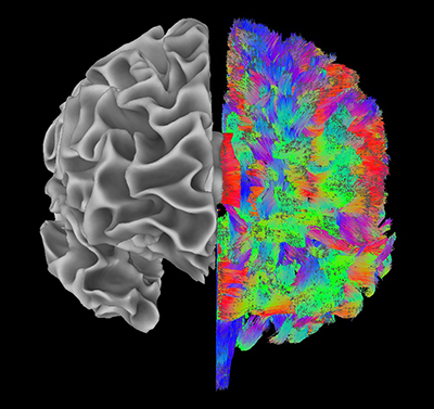  brain illustration--left half gray, right half in color