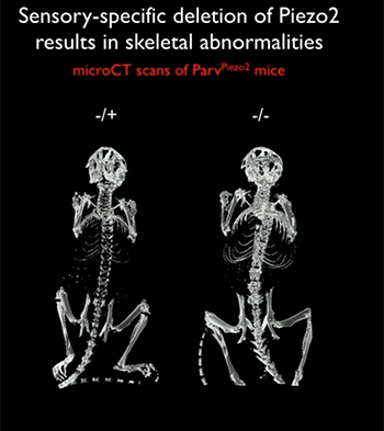 two mouse skeletons; one on right shows deformity in the hips