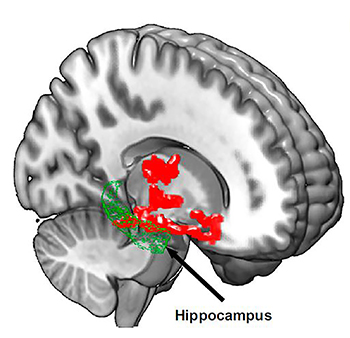 diagram of cross section of brain