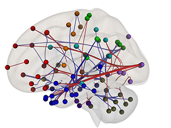 brain with red, blue, green, and orange tiny balls and connecting lines