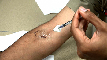 needle injecting substance into arm