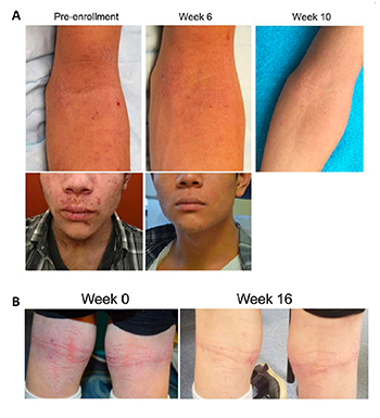 photos of arm, face, and leg skin before and after treatment