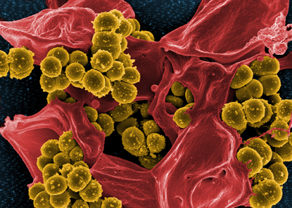 scanning electron microscope image of bacteria in red and yellow