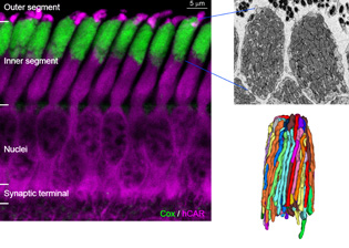 retina images