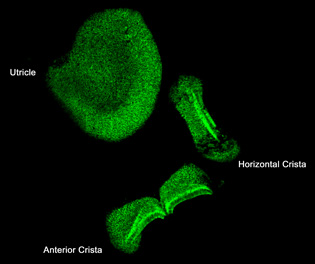HSP 70 expression (green color) in mouse inner ear